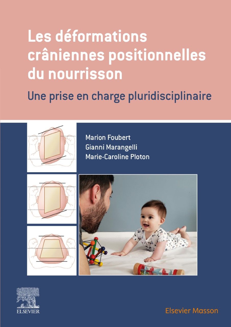 Quantifier et qualifier les déformations crâniennes positionnelles